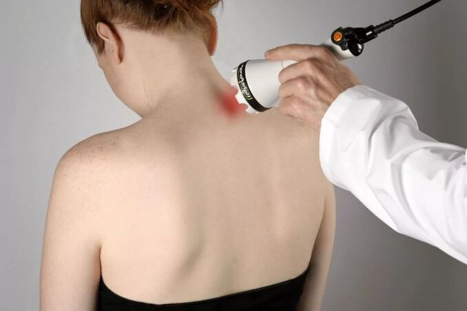 Physiotherapy for osteochondrosis