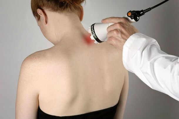Physiotherapy measures for the treatment of cervical osteochondrosis