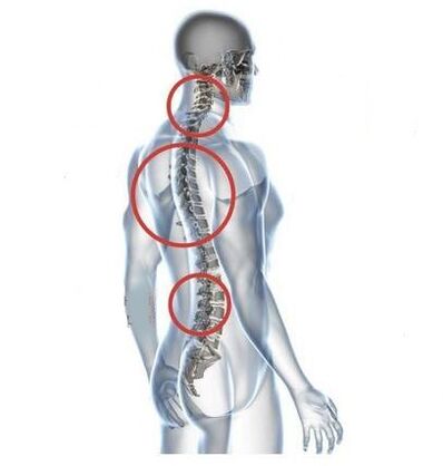 site of osteochondrosis of the spine