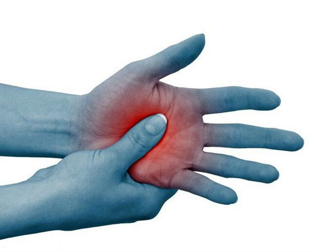 Severe pain in the finger joints, relieved by exercise, is a typical sign of rheumatoid arthritis.